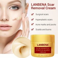 Lanbena Scar Removal Cream For New & Old Scars - Stretch Marks Relief And Burns Repair Acne Mark Removal Cream 10 Lanbena Scar Removal Cream For New & Old Scars - Stretch Marks Relief And Burns Repair Acne Mark Removal Cream -Moisturizers Sales 1dpv6qw6v7brel6mt2agdeckqn67