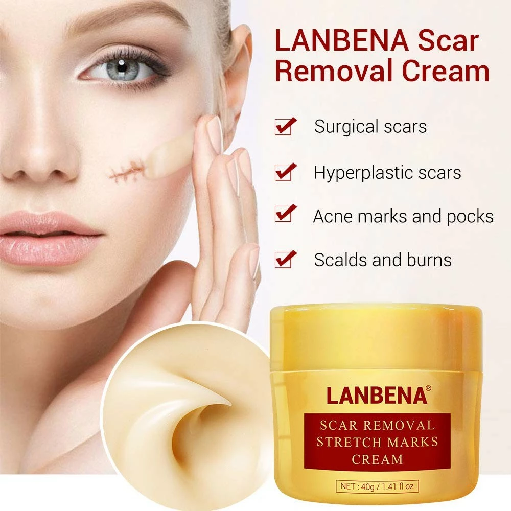 Lanbena Scar Removal Cream For New & Old Scars - Stretch Marks Relief And Burns Repair Acne Mark Removal Cream 4 Lanbena Scar Removal Cream For New & Old Scars - Stretch Marks Relief And Burns Repair Acne Mark Removal Cream - Image 2