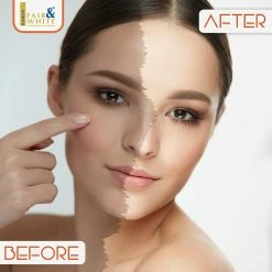 Fair & White Original Carrot Moisturizing Body Lotion With 1.9% Hydroquinone - Brightening & Clarifying, 485ml/ 17.0fl.oz. -Moisturizers Sales 2pqtgzaoc6d3e57fznyithvn1vrl