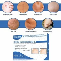 Africa's Best Store Africa's Best Organics Maximum Strength Extra Virgin Olive Oil Moisturizing Growth Lotion 12 Oz (Pack Of 4) -Moisturizers Sales 4okj77zpyldp27bdp2exl1dlskcw