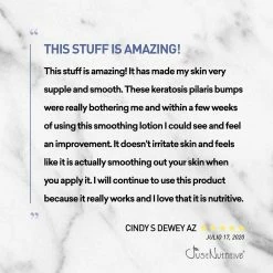 Just Nutritive Store ROUGH AND BUMPY SKIN LOTION / BUMP ERASER / RESCUE SKIN FROM ANNOYING BUMPS, DRY PATCHES, & KERATOSIS PILARIS / BEST LOTION FOR SOFT SKIN / JUST NUTRTIVE 8 OZ. -Moisturizers Sales 7si995aykqij6ub540so1l6bfeky