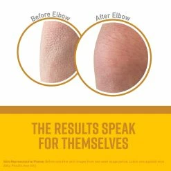 O´Keeffe´s O'Keeffe's Skin Repair Body Lotion And Dry Skin Moisturizer, 7.0 Ounce Tube, (Pack Of 2) -Moisturizers Sales 9hvc1n85d0yzs6vj5ti141quxnjp