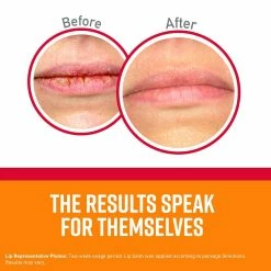 O'Keeffe's Store O'Keeffe's Lip Repair Seal & Heal Lip Balm (Pack Of 2) -Moisturizers Sales d6xloy0rfg8srlnseatjs1rg7koh