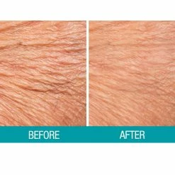 Dermactin Crepe Away Body Souffle 13 Dermactin Crepe Away Body Souffle -Moisturizers Sales hueva2ag764rcugrlluk4205oxm9