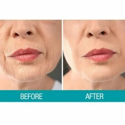 Dermactin-TS Crepe Be Gone Body Souffle 3 Ounce (2-Pack) 19 Dermactin-TS Crepe Be Gone Body Souffle 3 Ounce (2-Pack) -Moisturizers Sales iseowba8qtg2nld45vh23mij79xm