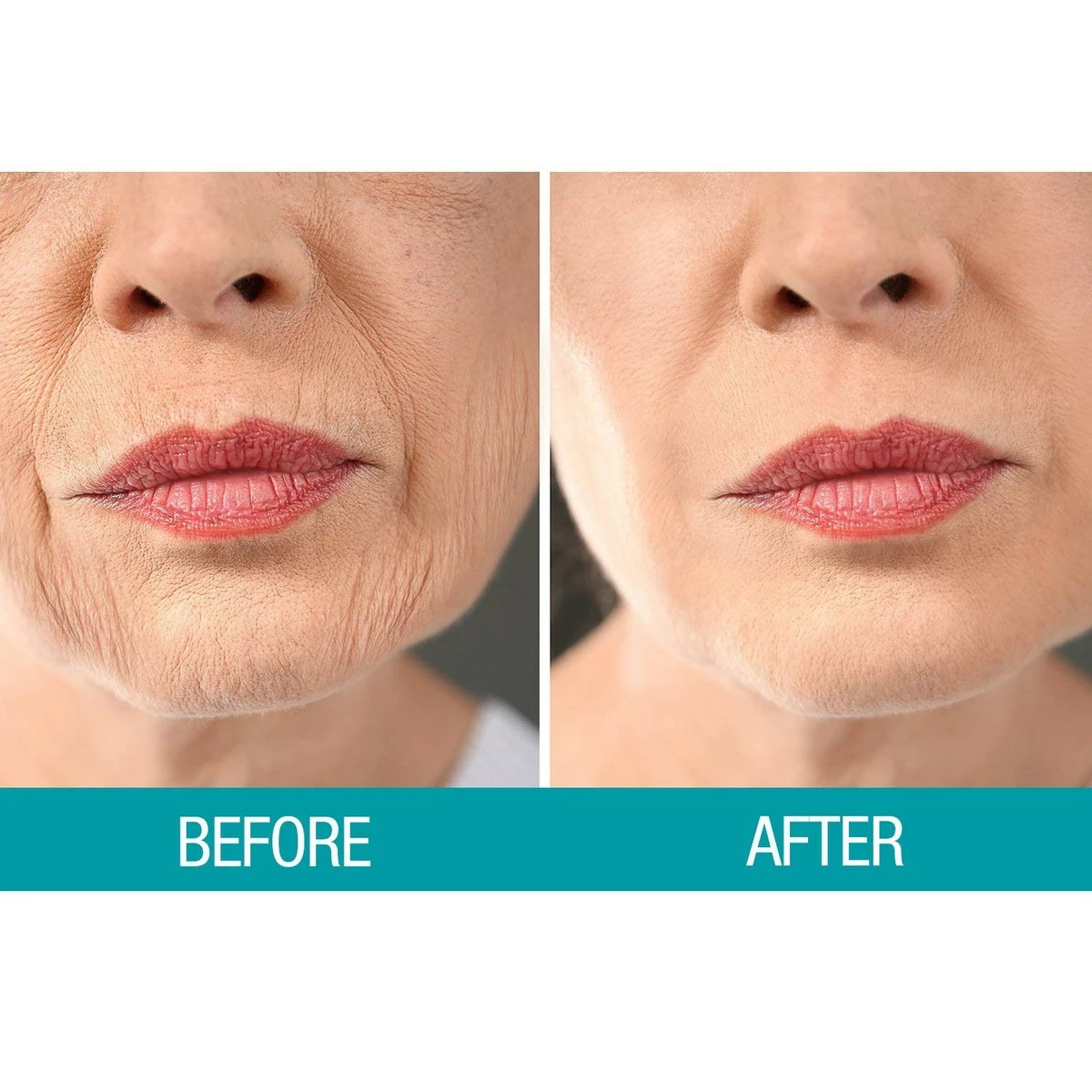 Dermactin-TS Crepe Be Gone Body Souffle 3 Ounce (2-Pack) 11 Dermactin-TS Crepe Be Gone Body Souffle 3 Ounce (2-Pack) - Image 9