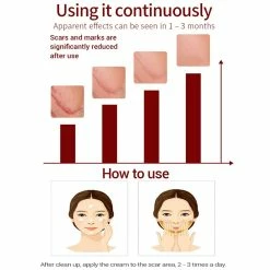 Lanbena Scar Removal Cream For New & Old Scars - Stretch Marks Relief And Burns Repair Acne Mark Removal Cream 14 Lanbena Scar Removal Cream For New & Old Scars - Stretch Marks Relief And Burns Repair Acne Mark Removal Cream -Moisturizers Sales jfmpqx6y7ii3cimcm3q2rre55i67