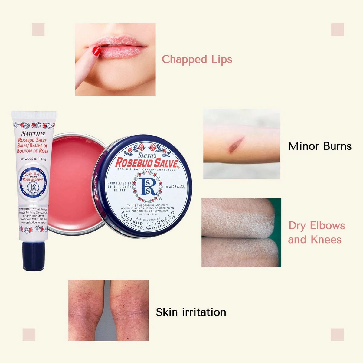 Smith’s Rosebud Salve, Lip Balm And Lip Balm Holder Keychain Bundle - Natural Lip Care Moisturizer, All-Purpose And Case For Teens, Women And Men (Rosebud Salve) 6 Smith’s Rosebud Salve, Lip Balm And Lip Balm Holder Keychain Bundle - Natural Lip Care Moisturizer, All-Purpose And Case For Teens, Women And Men (Rosebud Salve) - Image 4