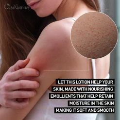 Just Nutritive Store ROUGH AND BUMPY SKIN LOTION / BUMP ERASER / RESCUE SKIN FROM ANNOYING BUMPS, DRY PATCHES, & KERATOSIS PILARIS / BEST LOTION FOR SOFT SKIN / JUST NUTRTIVE 8 OZ. -Moisturizers Sales kzfvlnooeakul2twejwj69d4gia7