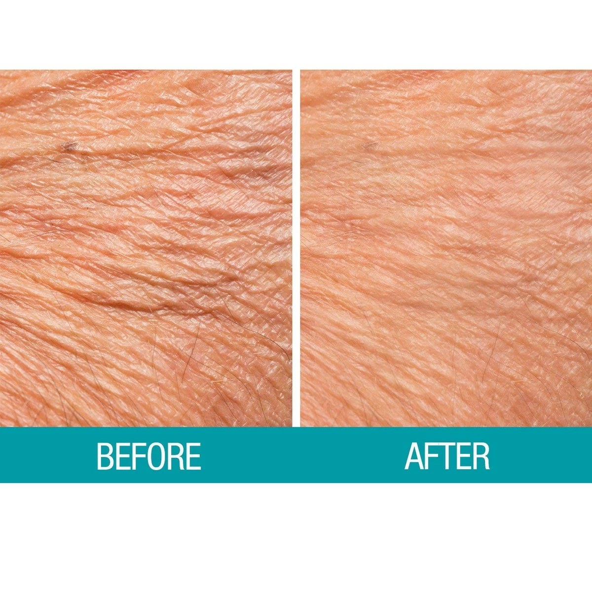 Dermactin-TS Crepe Be Gone Body Souffle 3 Ounce (2-Pack) 10 Dermactin-TS Crepe Be Gone Body Souffle 3 Ounce (2-Pack) - Image 8