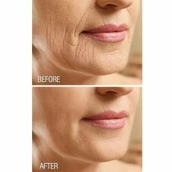 Dermactin-TS Crepe Be Gone Body Souffle 3 Ounce (2-Pack) 16 Dermactin-TS Crepe Be Gone Body Souffle 3 Ounce (2-Pack) -Moisturizers Sales xt3i7cudezocc0ictj7cmxohrk2g