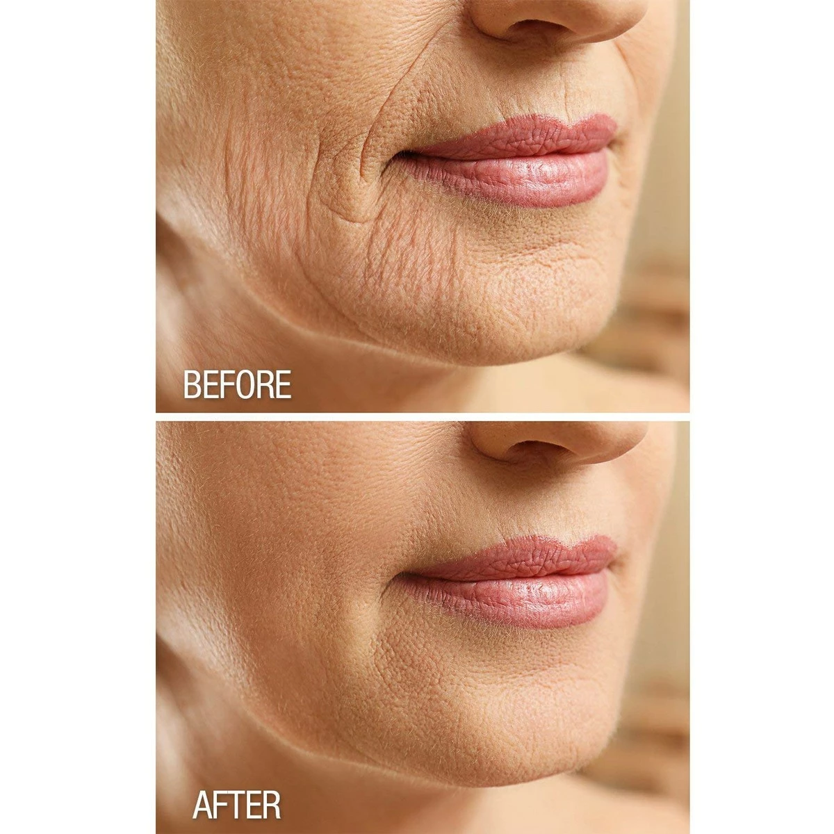 Dermactin-TS Crepe Be Gone Body Souffle 3 Ounce (2-Pack) 8 Dermactin-TS Crepe Be Gone Body Souffle 3 Ounce (2-Pack) - Image 6